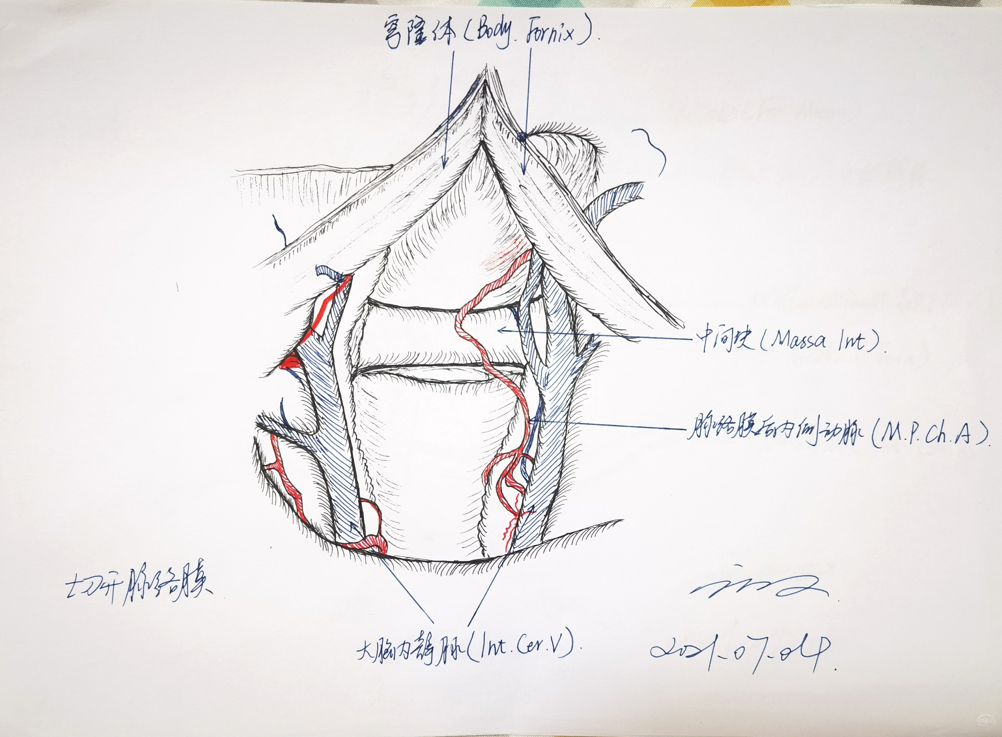 学习rhoton解剖学手绘—穹窿间入路.