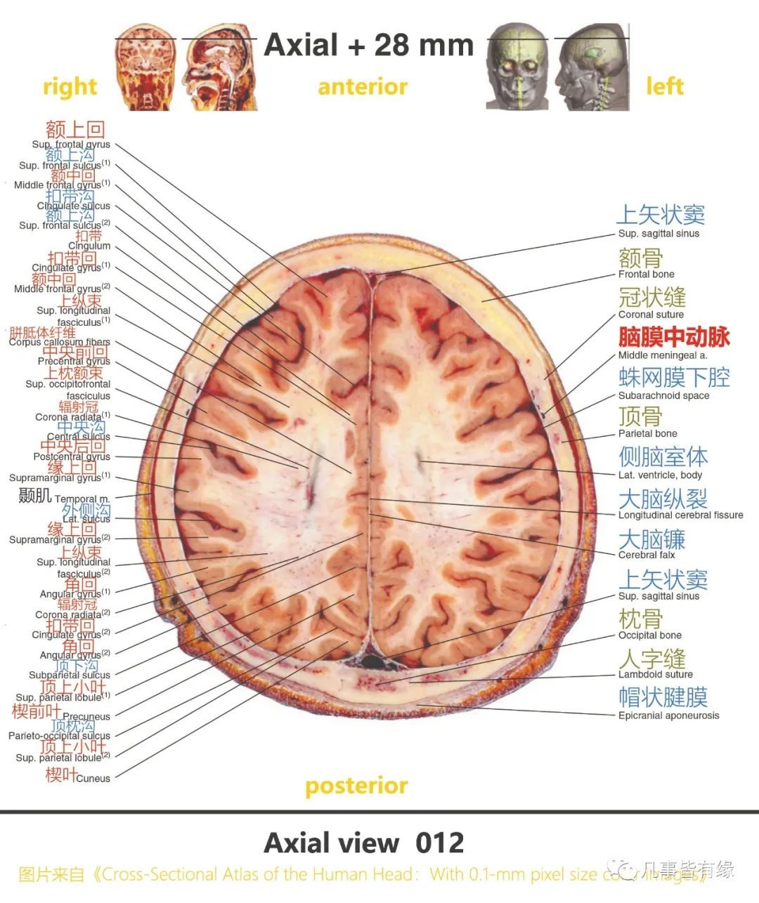 二,大脑轴位断层示意图section anatomy三,尸头标本与线条图结合的