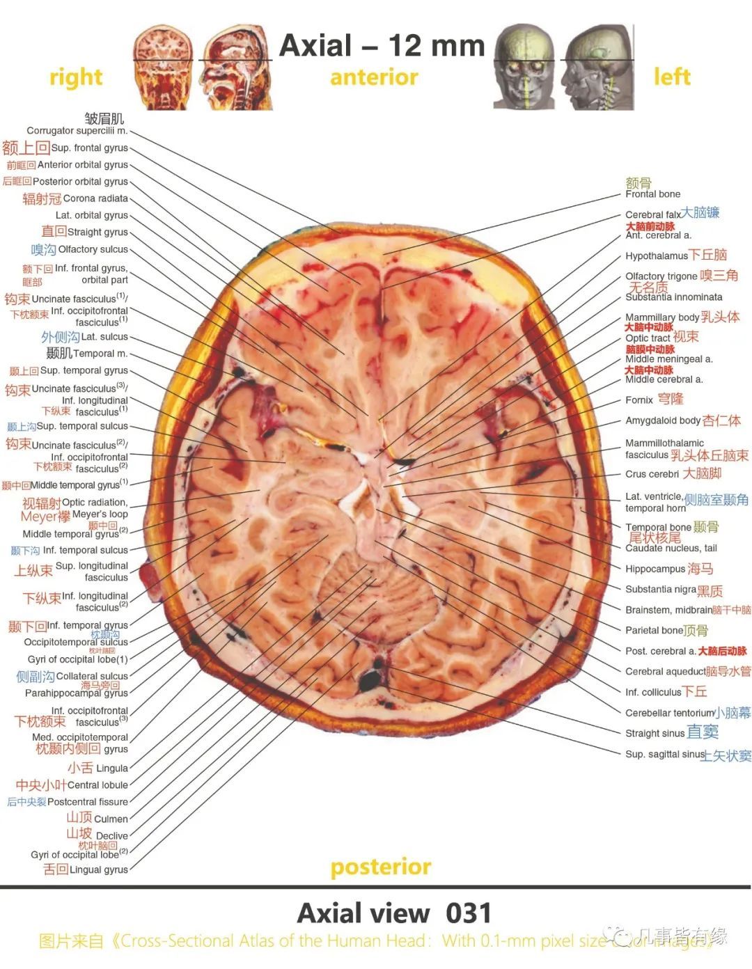 颅脑断层解剖轴位