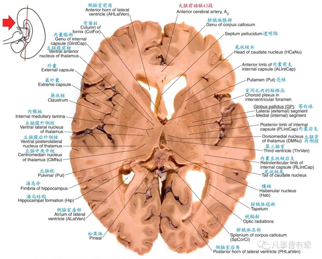 颅脑mri断层解剖结构标注section anatomy五,脑干轴位断层解剖示意图