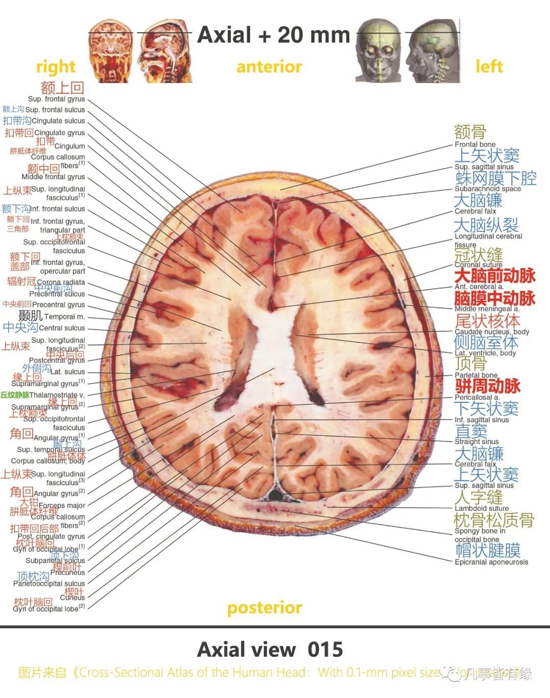 颅脑mri断层解剖结构标注section anatomy五,脑干轴位断层解剖示意图