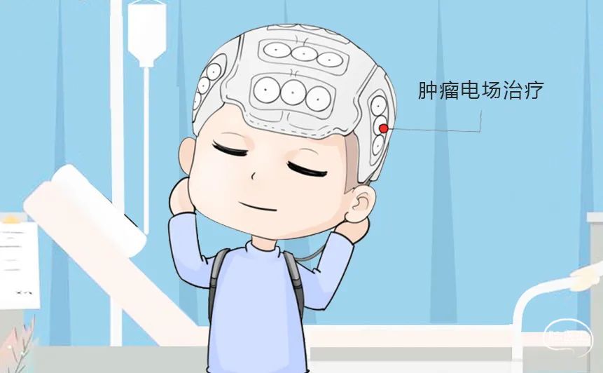 胶质瘤患者必读:从确诊到治疗,你知道自己将会经历哪些"考验"吗?