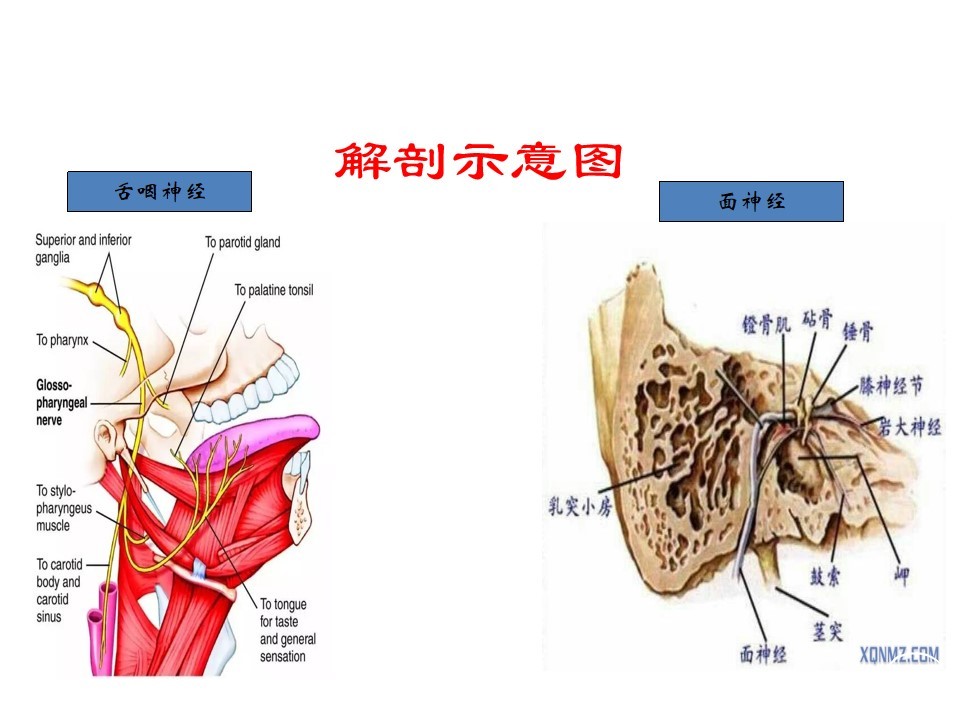 面肌痉挛治疗新技术-ct引导下茎乳孔面神经射频