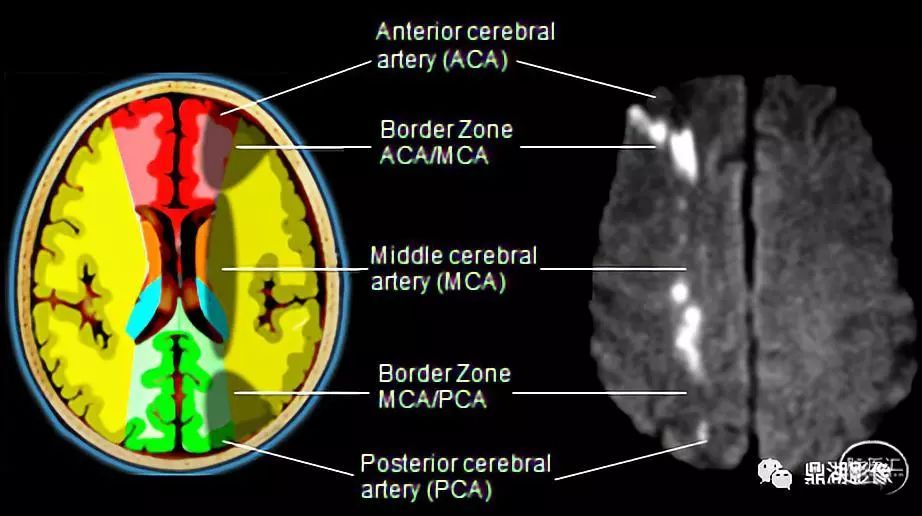 脑供血图谱和脑血管病变