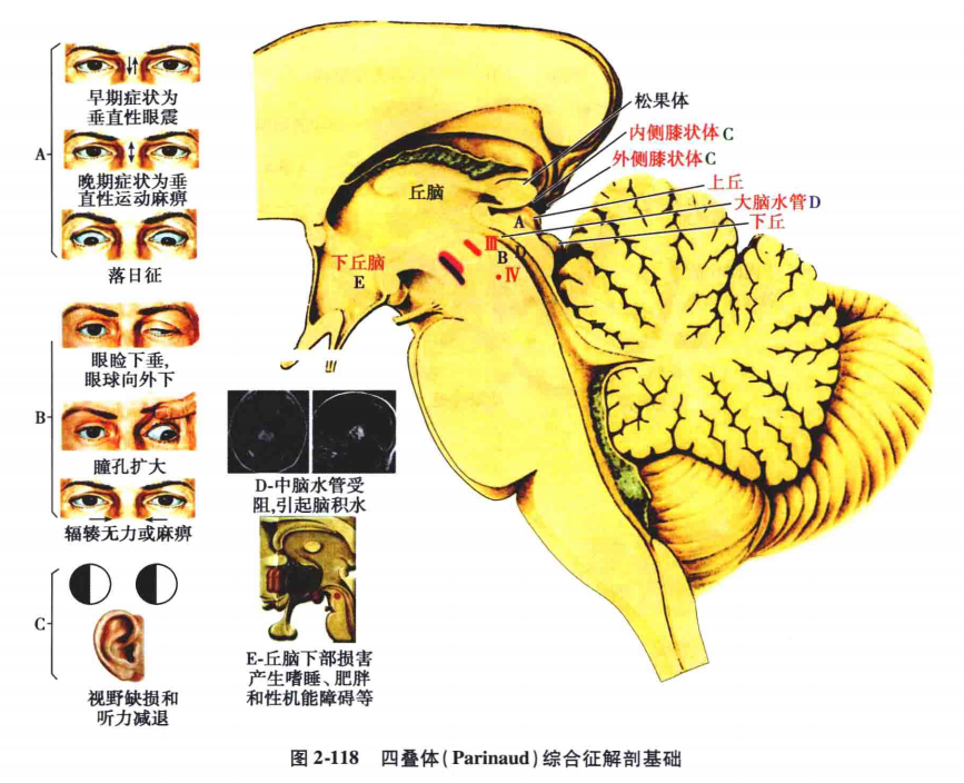 动眼神经缩瞳核图片