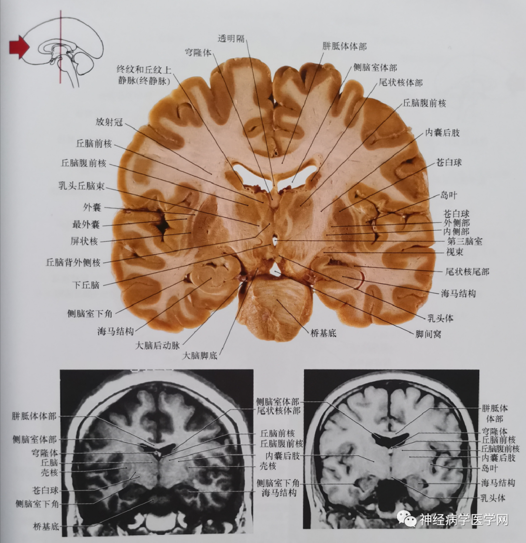 临床神经解剖图谱断层影像切片